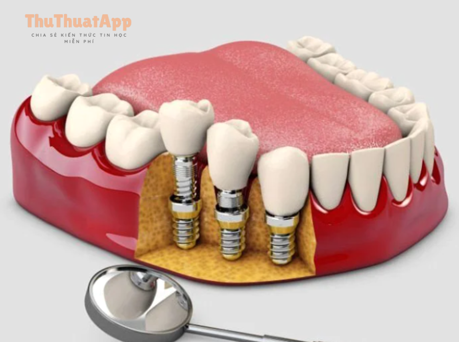 Hướng dẫn dùng Commute (Đi làm) trên Google Maps cho dân văn phòng 2 Giao thông đô thị đông đúc minh họa cho chế độ Commute trên Google Maps